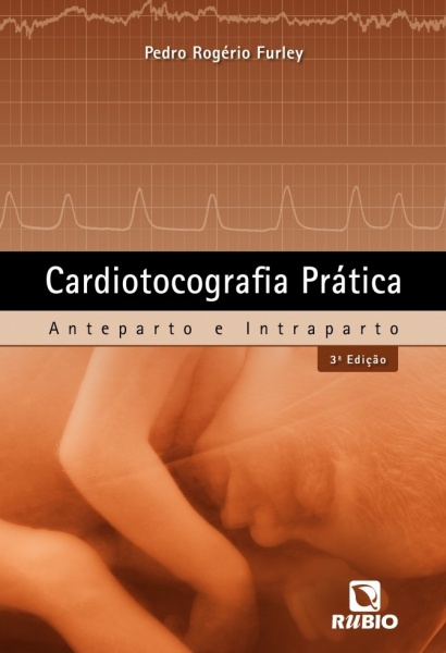 Cardiotocografia Prática - Anteparto e Intraparto
