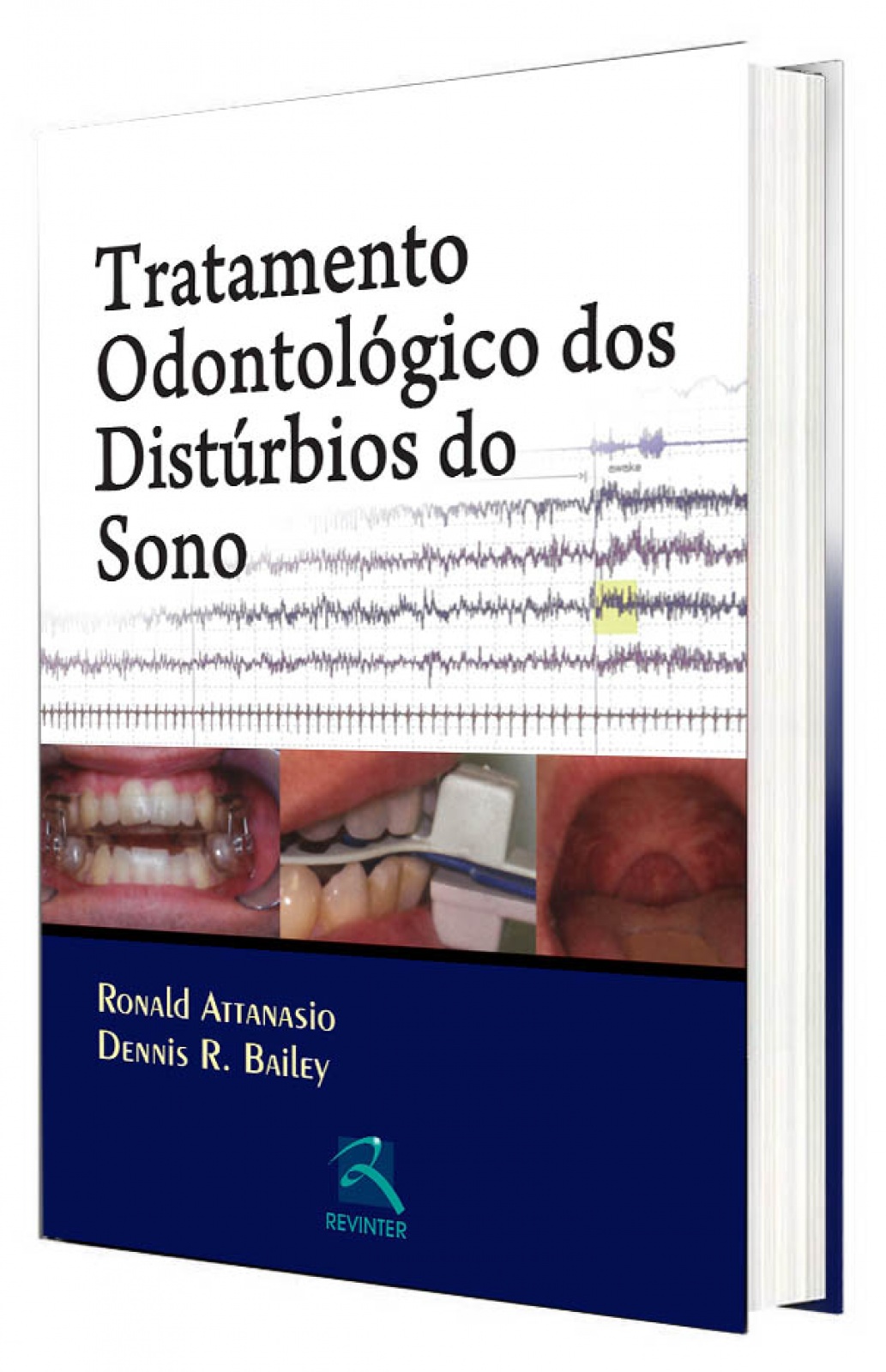 Tratamento Odontologico Dos Distúrbios Do Sono