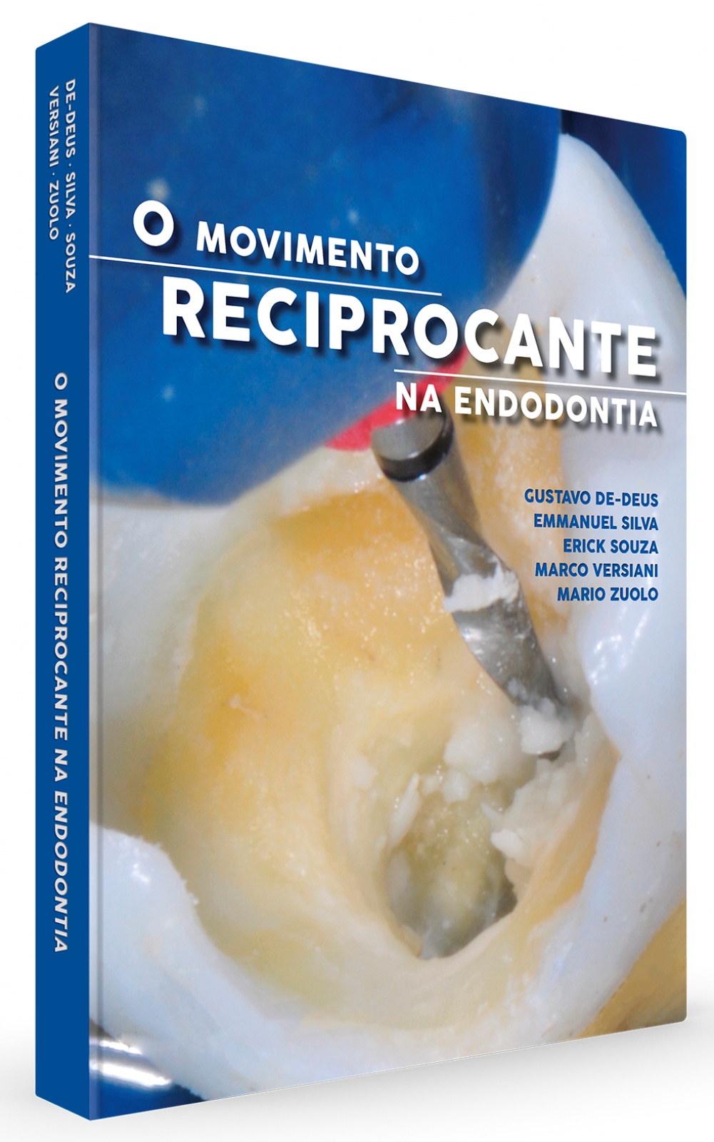 O Movimento Reciprocante Na Endodontia