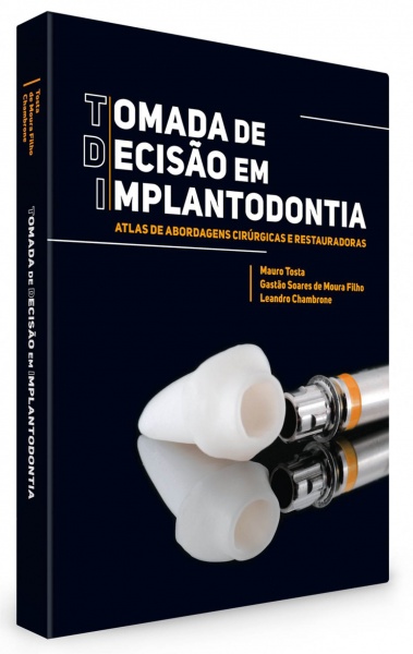 Tomada De Decisão Em Implantodontia Atlas De Abordagens Cirúrgicas E Restauradoras