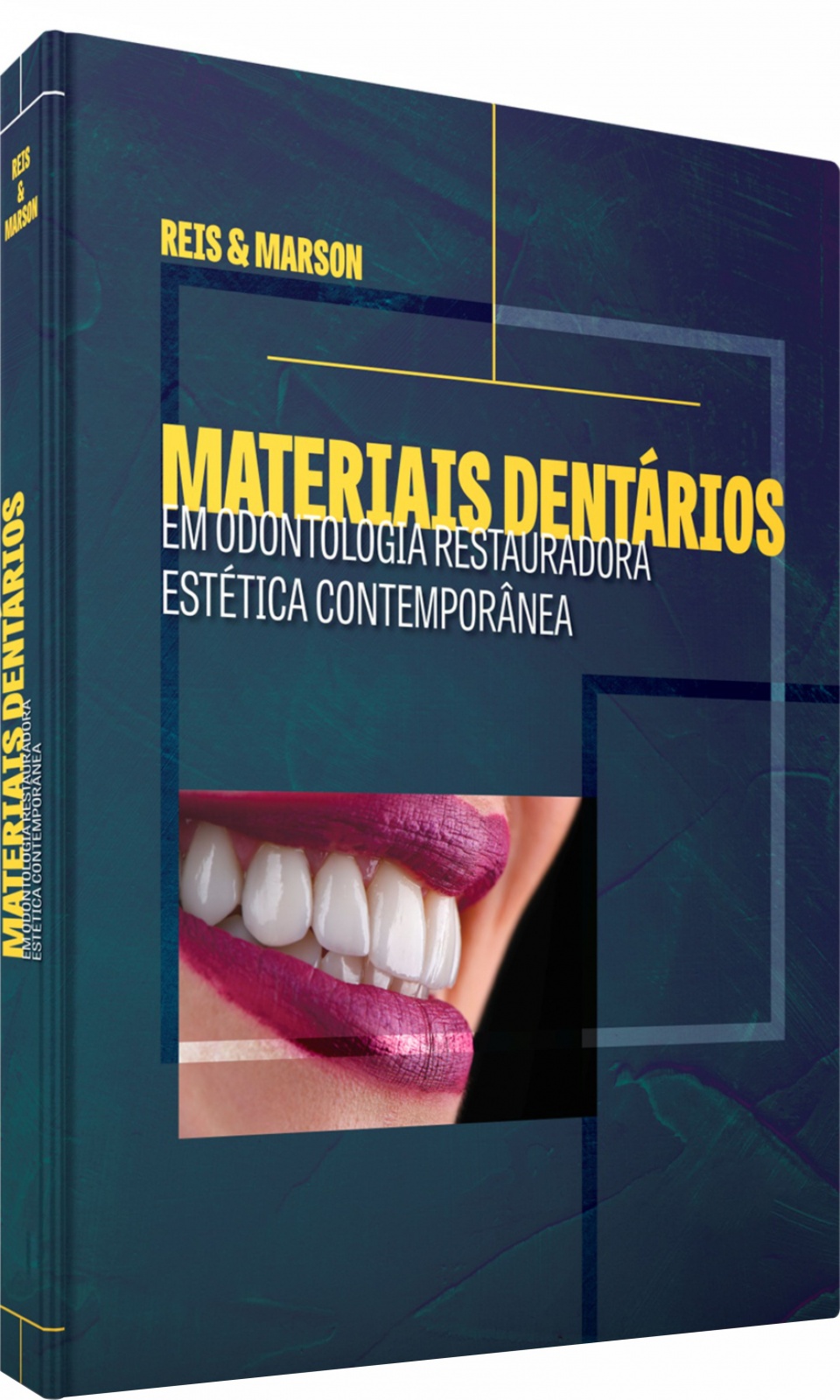 Materiais Dentários – Em Odontologia Restauradora Estética Contemporânea