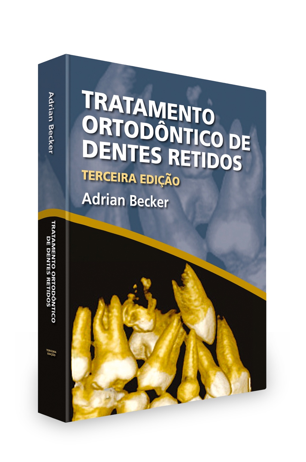Tratamento Ortodôntico De Dentes Retidos