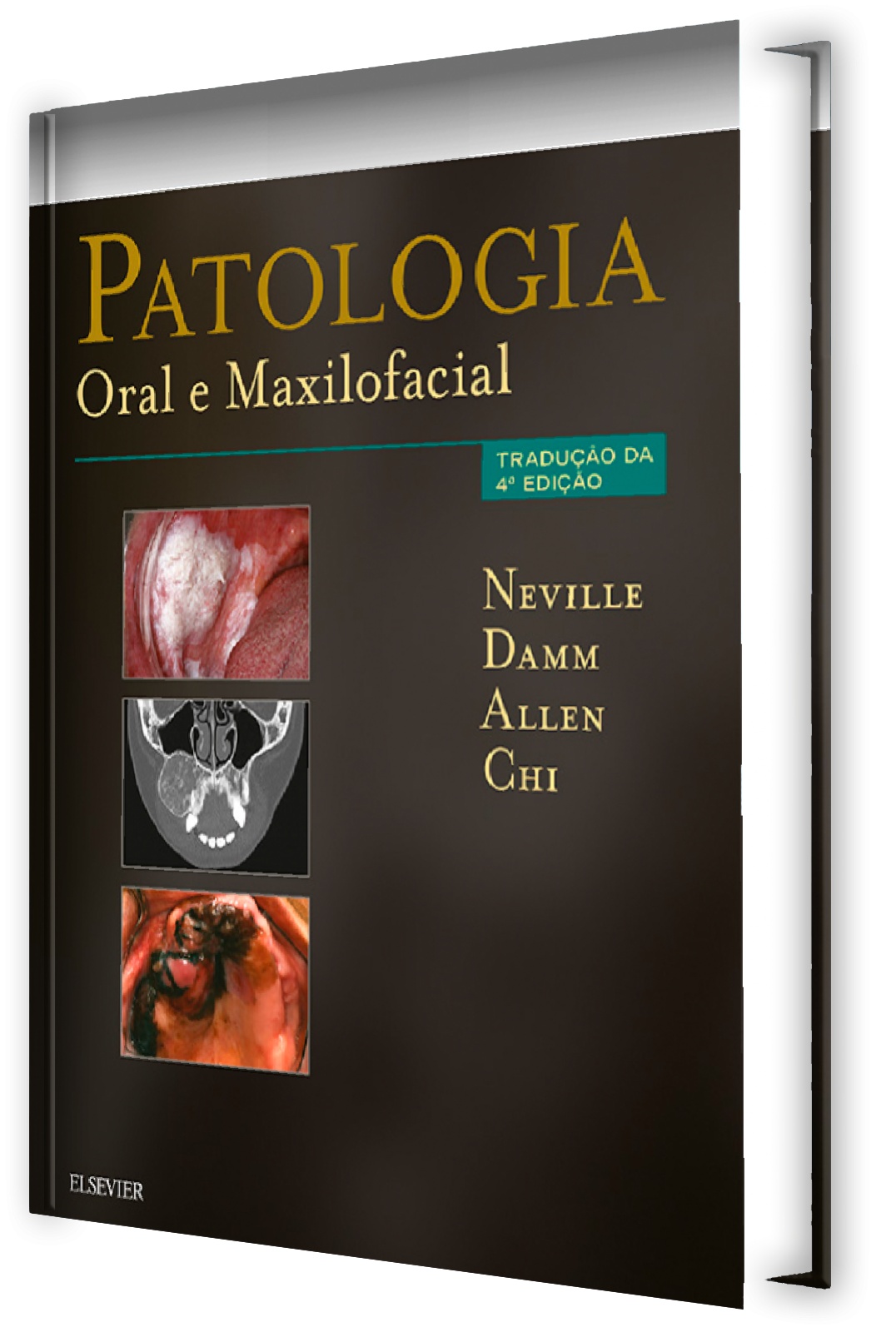 Patologia Oral E Maxilofacial - 4ª Edição