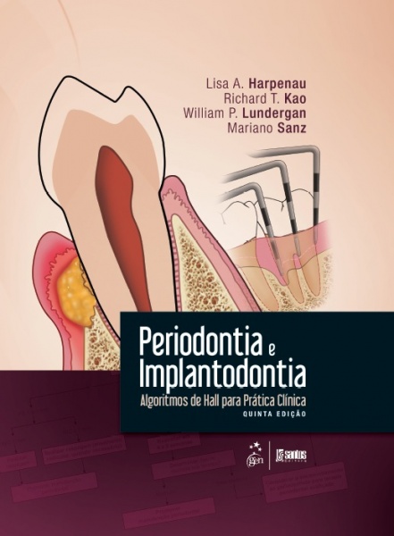 Periodontia E Implantodontia - Algoritmos De Hall Para Prática Clínica