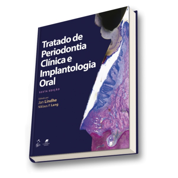 Tratado De Periodontia Clínica E Implantologia Oral