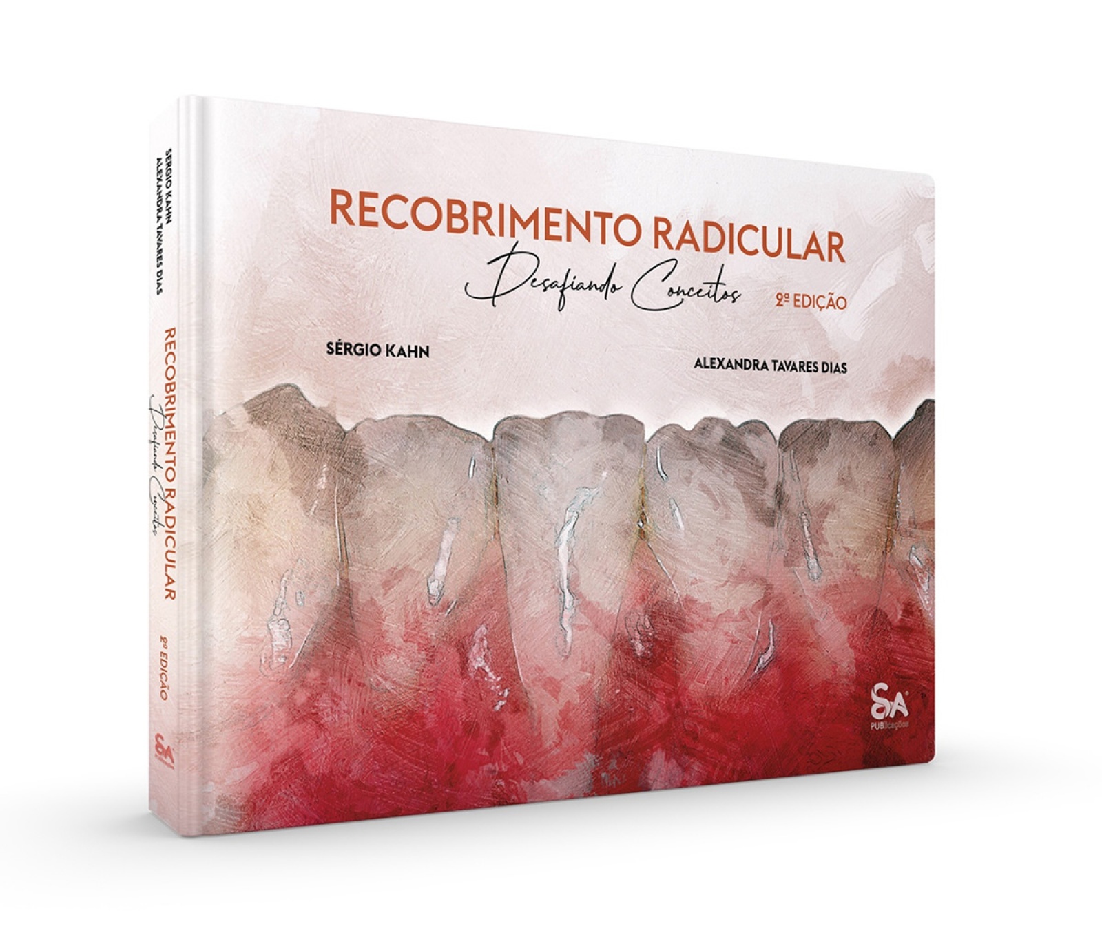 Recobrimento Radicular – Desafiando Conceitos