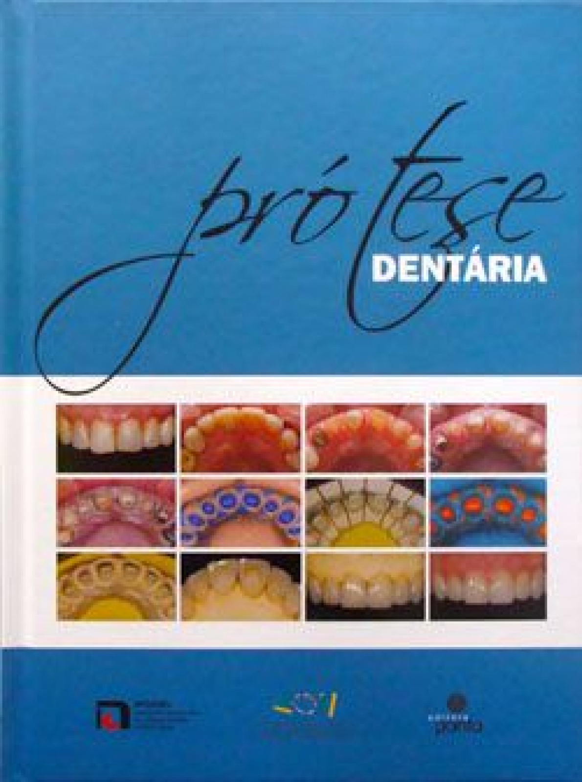 Prótese Dentária