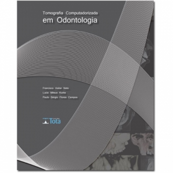 Tomografia Computadorizada Em Odontologia