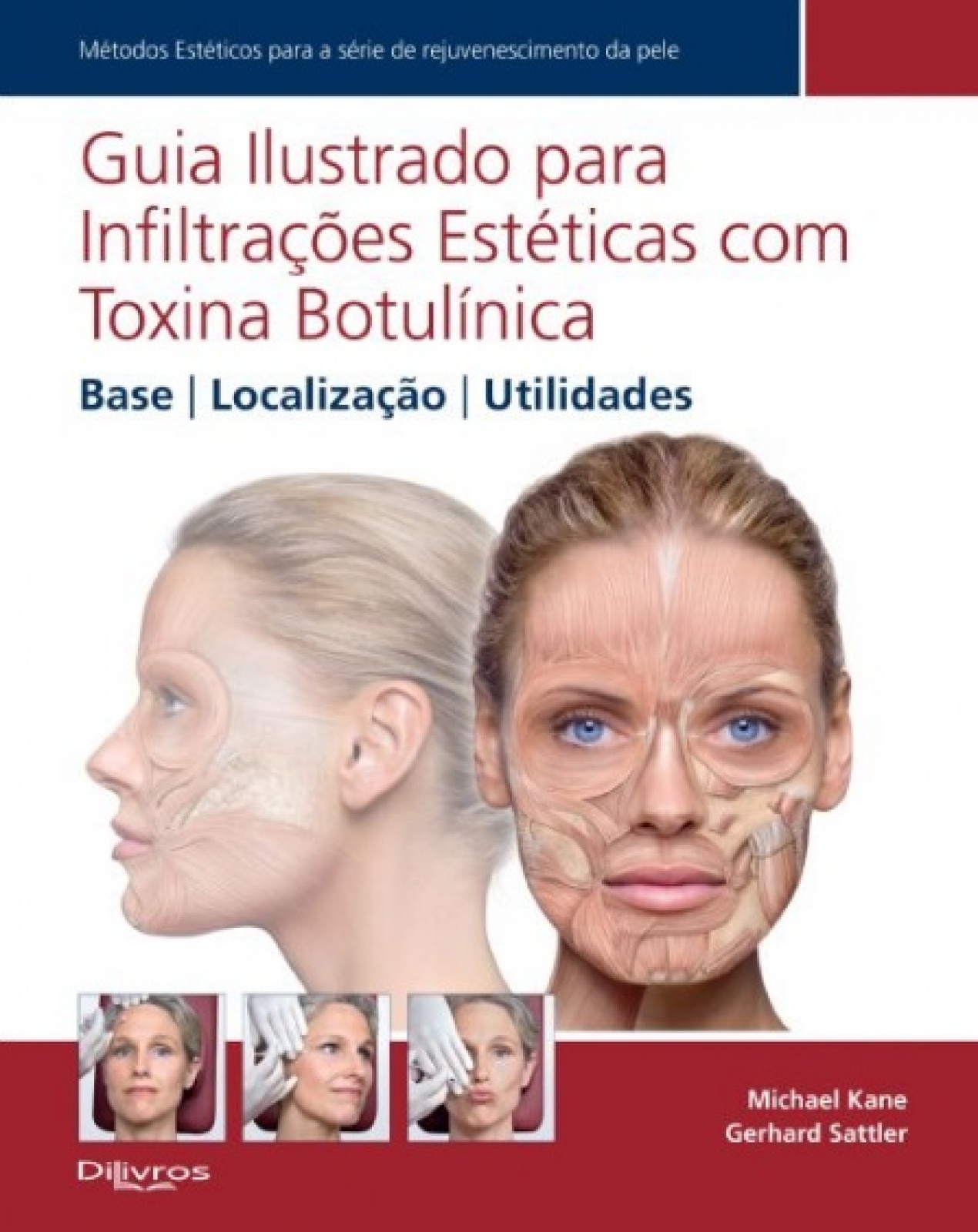 Guia Ilustrado Para Infiltrações Estéticas Com Toxina Botulínica - Base | Localização | Utilidades