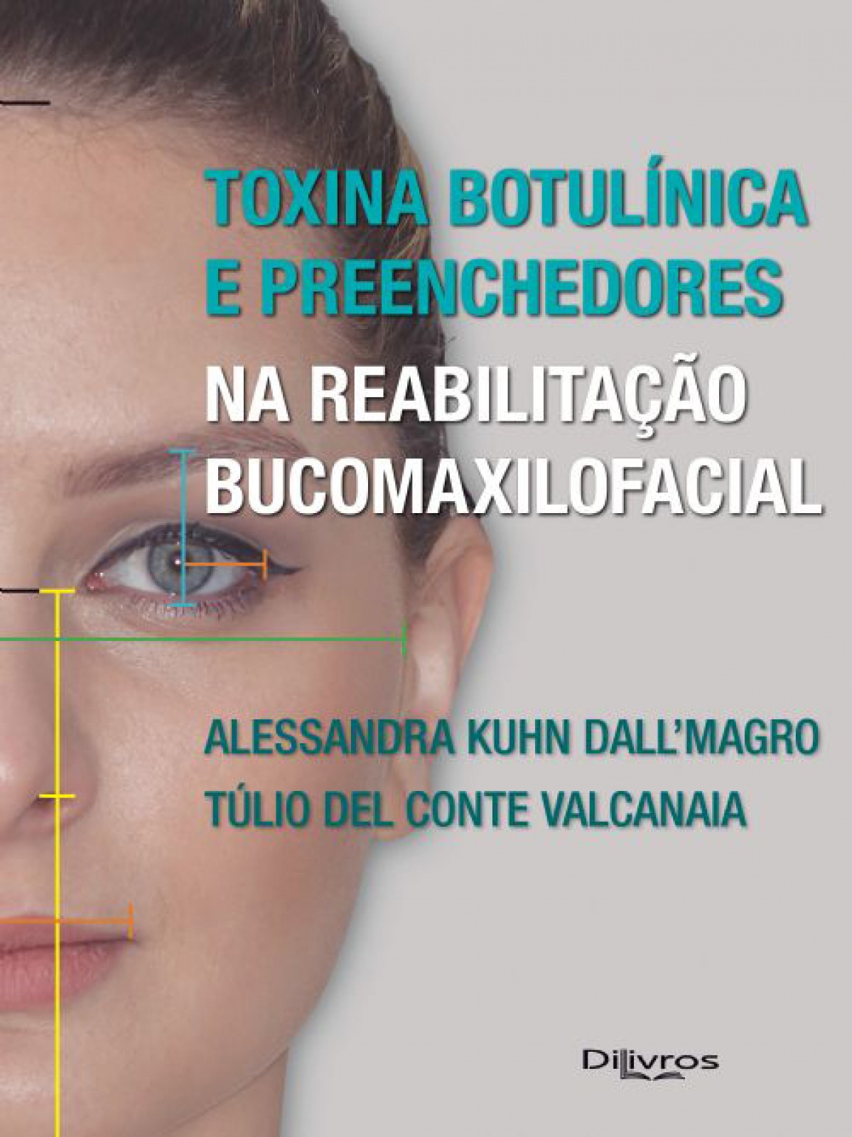 Toxina Botulinica E Preenchedores Na Reabilitacao Bucomaxilofacial