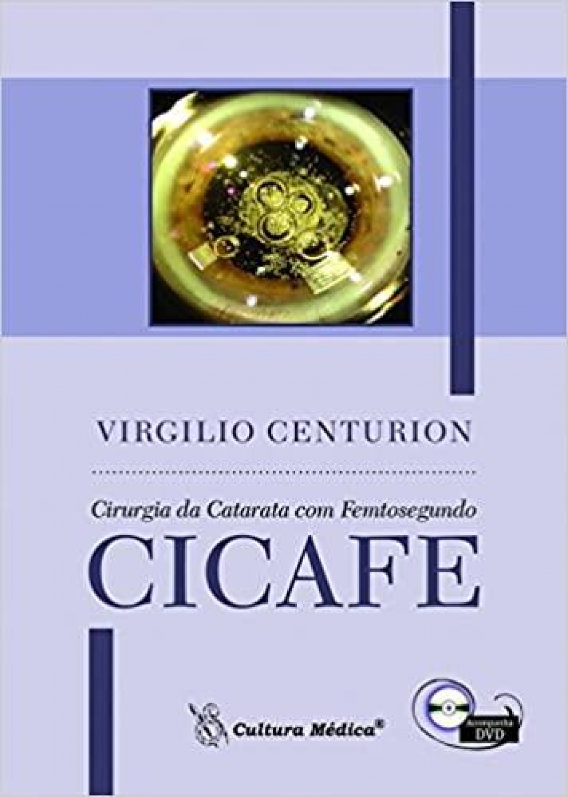 Cicafe - Cirurgia Da Catarata Com Femtosegundo 