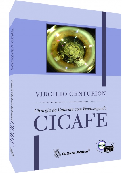 Cicafe - Cirurgia Da Catarata Com Femtosegundo 