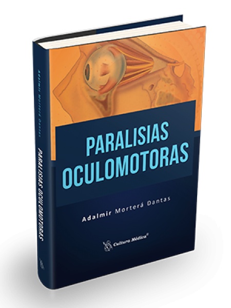 Paralisias Oculomotoras