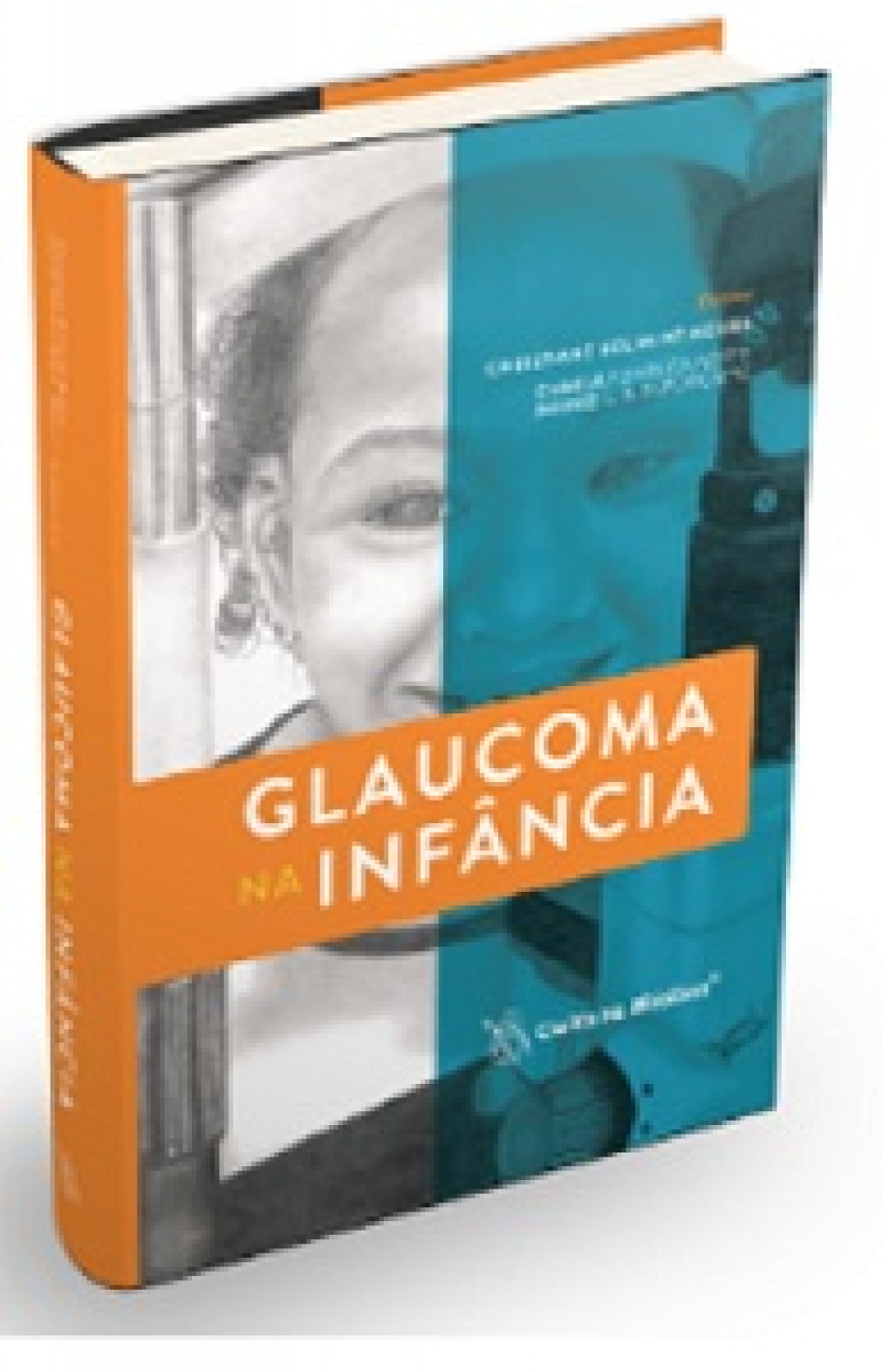 Glaucoma Na Infância