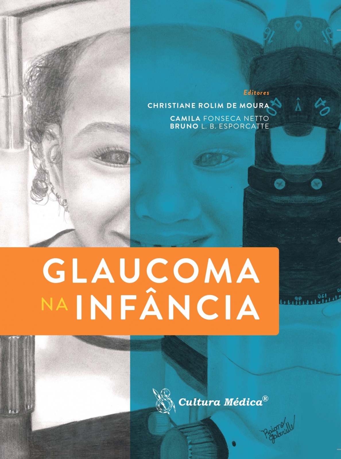 Glaucoma Na Infância