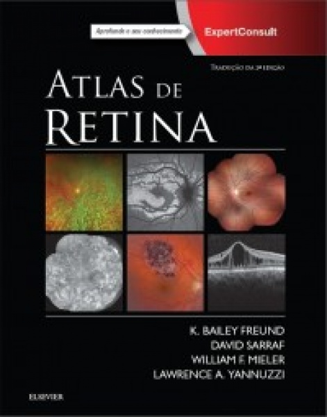 Atlas De Retina- 2A Edição