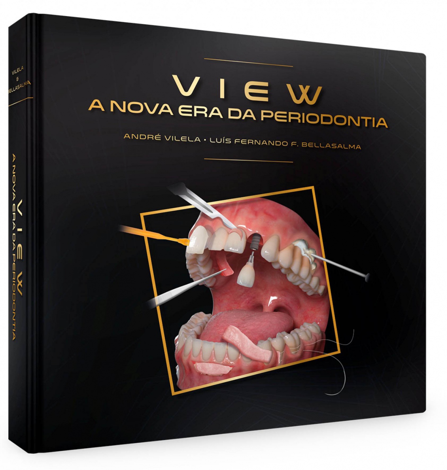 View: A Nova Era Da Periodontia