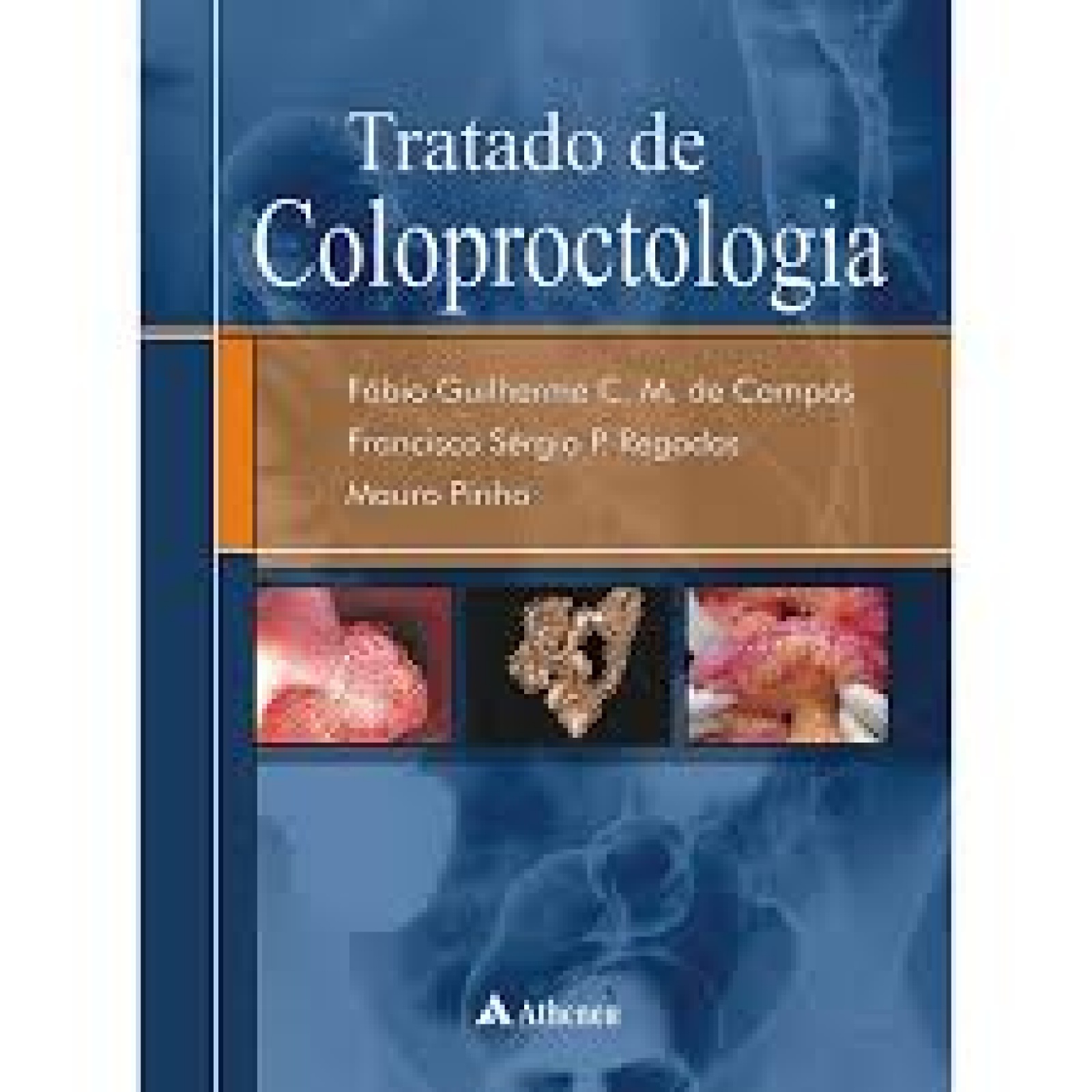 Tratado De Coloproctologia