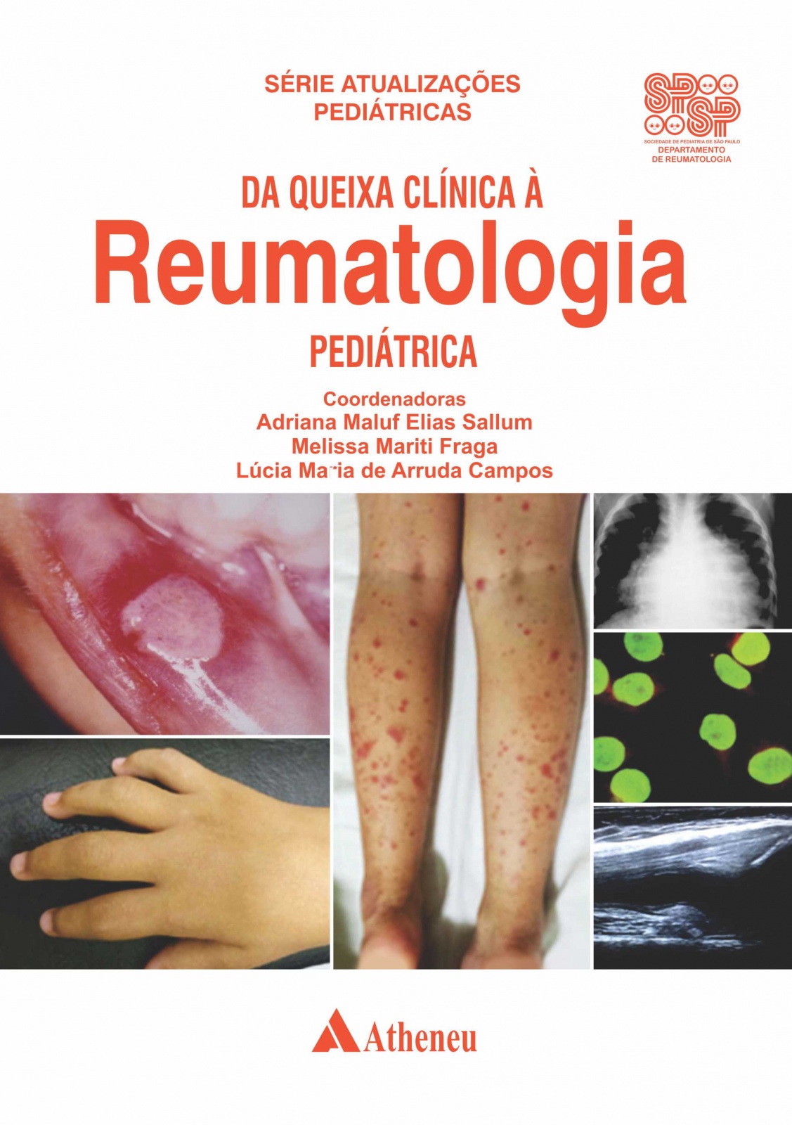 Da Queixa Clínica À Reumatologia Pediátrica