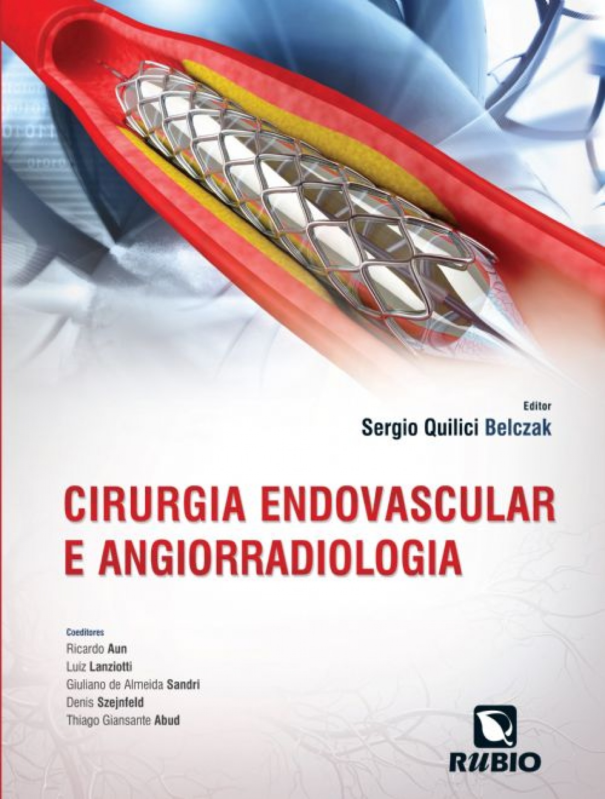 Cirurgia Endovascular E Angiorradiologia