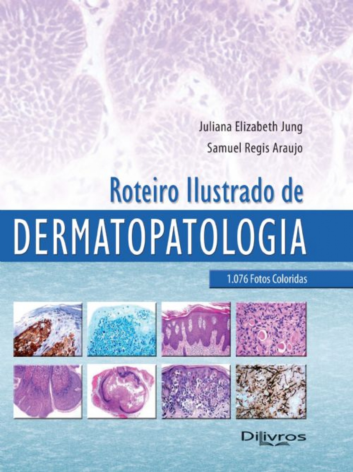 Roteiro Ilustrado De Dermatopatologia 