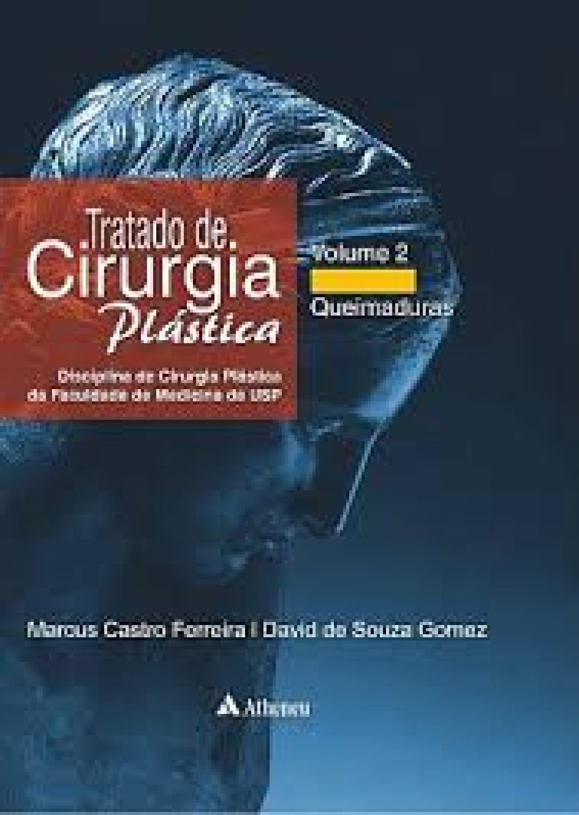 Tratado De Cirurgia Plástica – Vol.2 Queimaduras