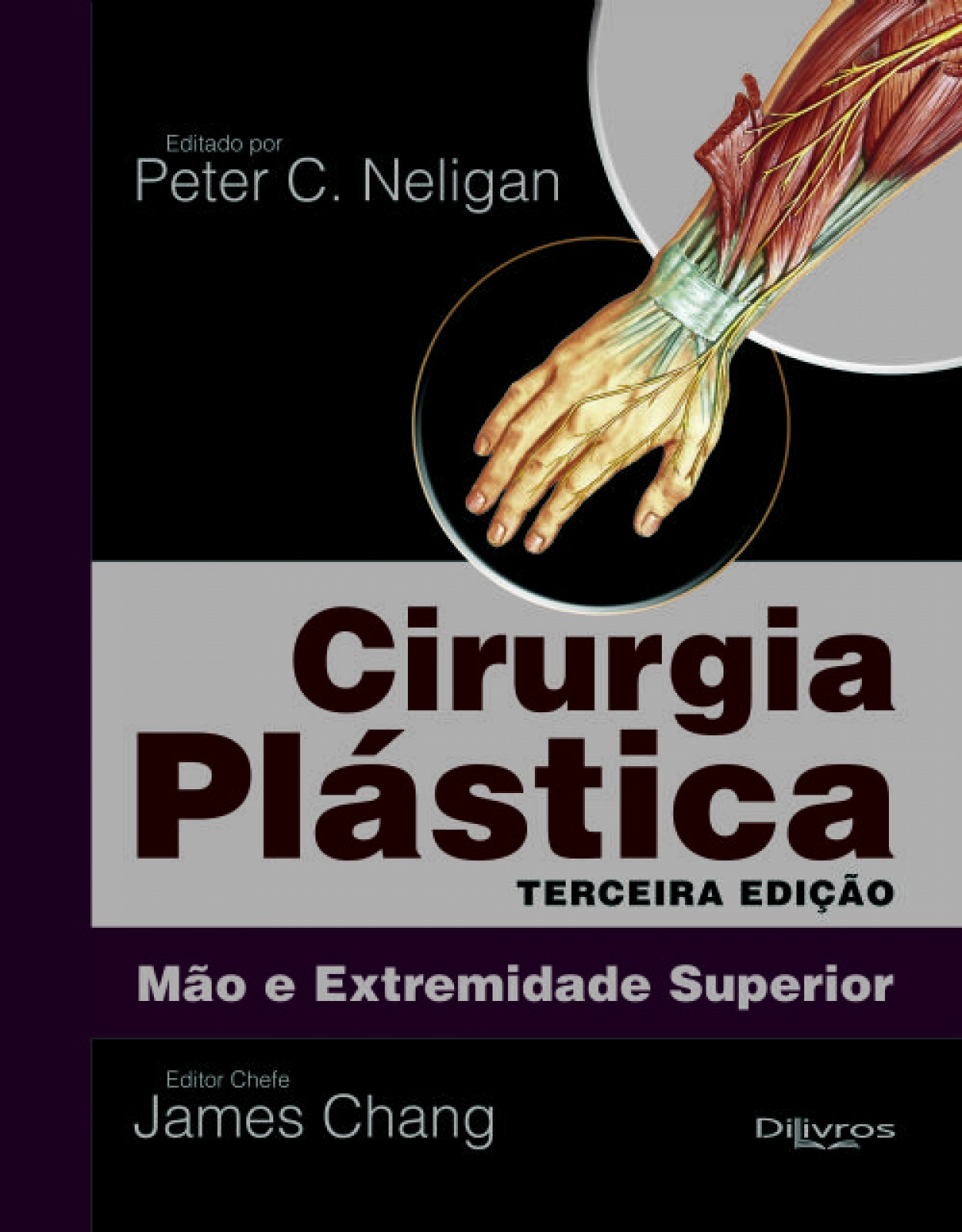 Cirurgia Plastica De Mão E Extremidade Superior