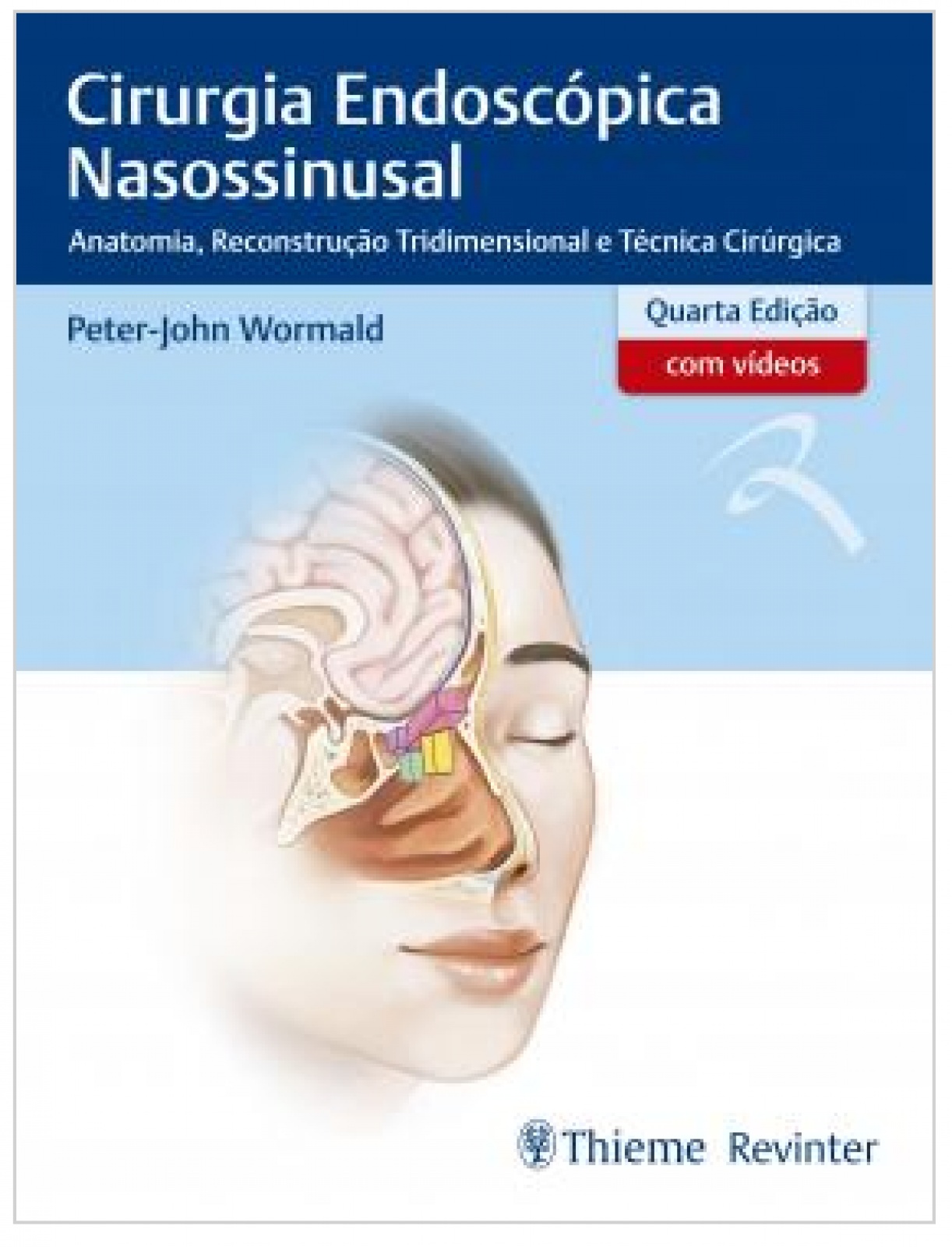 Cirurgia Endoscópica Nasossinusal: Anatomia, Reconstrução Tridimensional E Técnica Cirúrgica