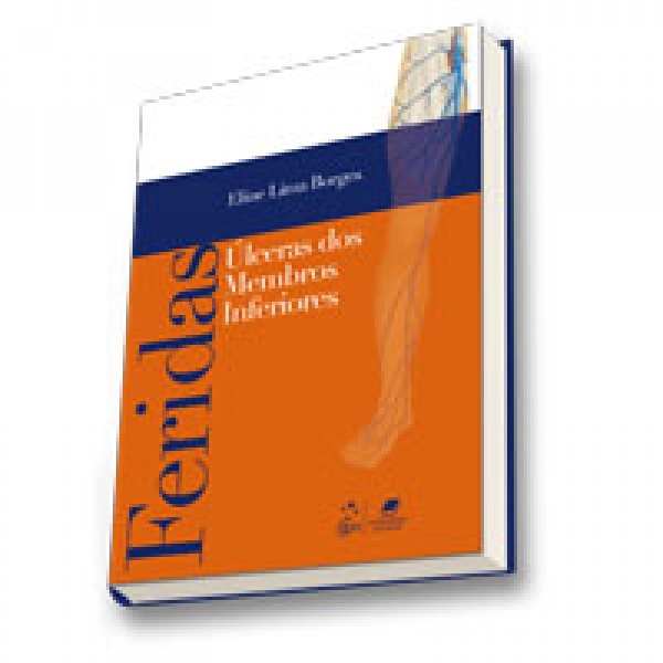 Úlceras De Membros Inferiores