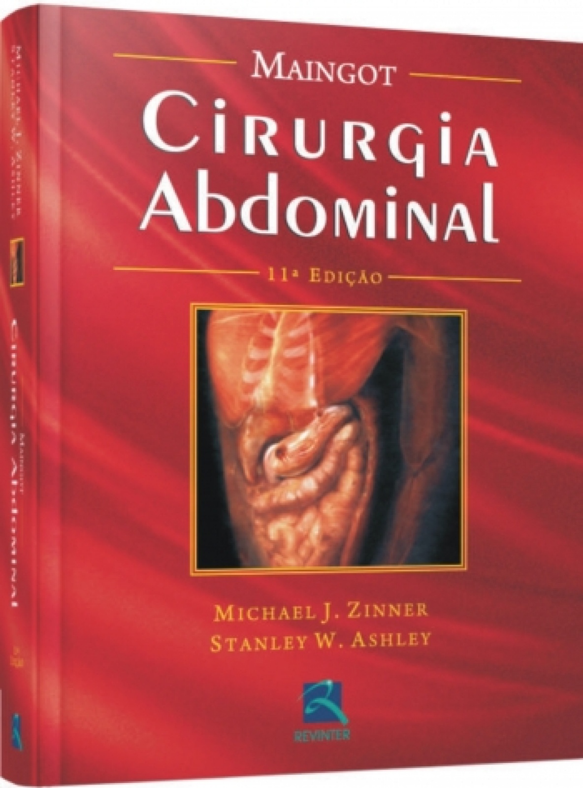 Cirurgia Abdominal