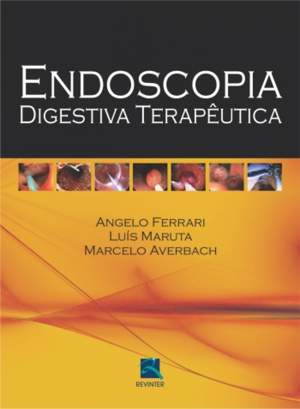 Endoscopia Digestiva Terapeutica