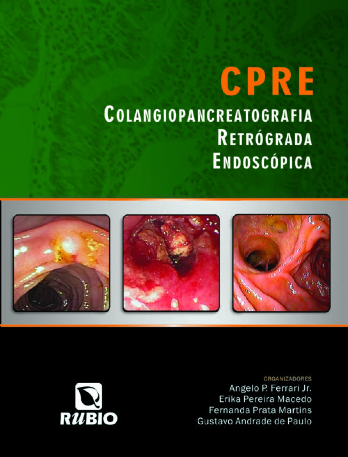 Cpre – Colangiopancreatografia Retrógrada Endoscópica