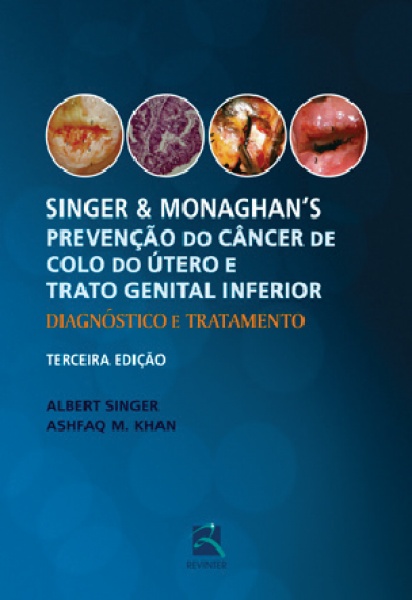 Singer & Monaghan’S - Prevenção Do Câncer De Colo Do Útero E Trato Genital Inferior - Diagnóstico E Tratamento, 3ª Edição