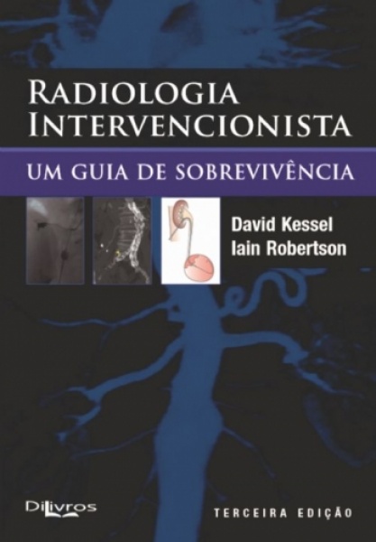 Radiologia Intervencionista - Um Guia De Sobrevivência