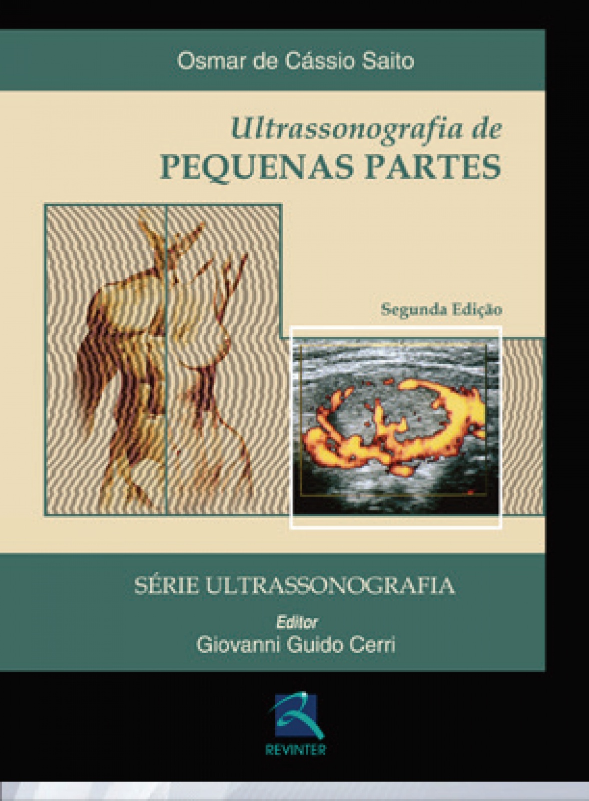 Ultrassonografia De Pequenas Partes - Série Ultrassonografia, 2ª Edição