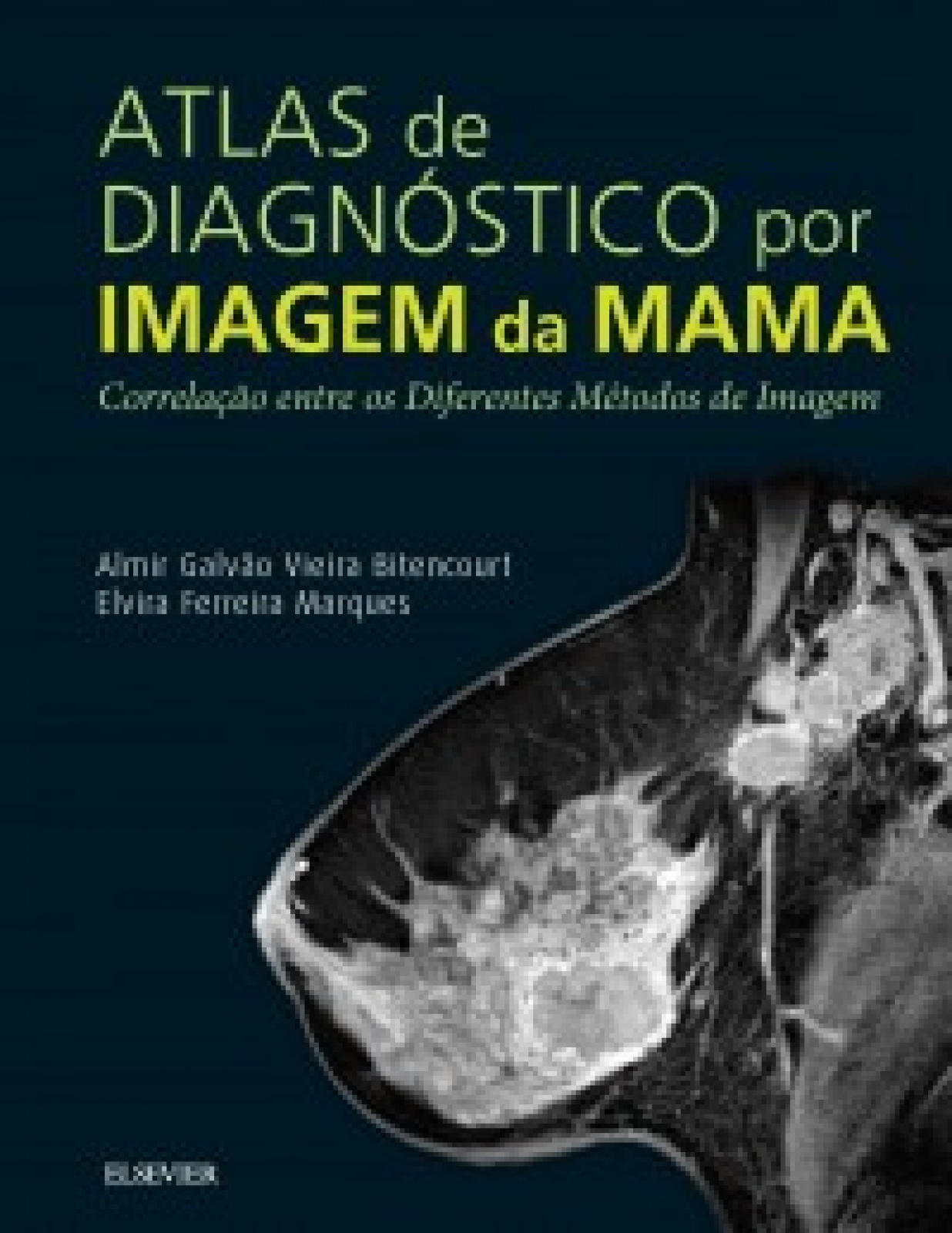 Atlas De Diagnóstico Por Imagem De Mama- 1A Edição