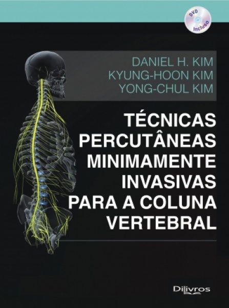 Técnicas Percutâneas Minamente Invasivas Para Coluna Vetebral