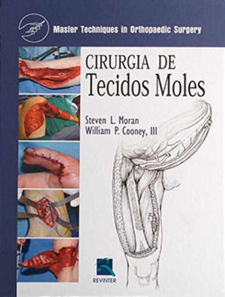 Cirurgia De Tecidos Moles - Master Techniques In Orthopaedic Surgery