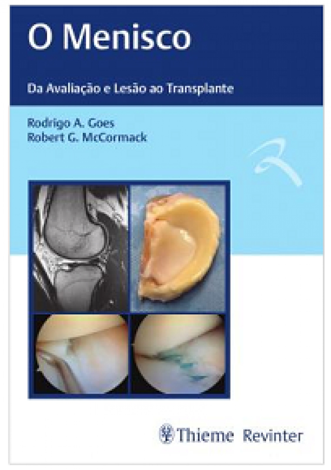 O Menisco - Da Avaliação E Lesão Ao Transplante