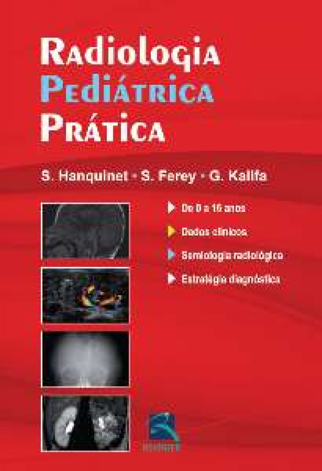 Radiologia Pediátrica Prática