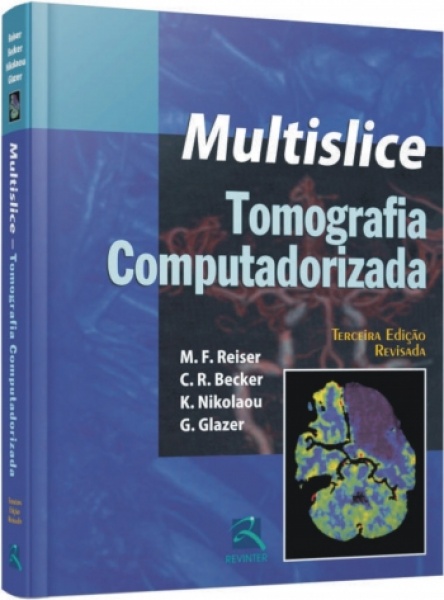 Tomografia Computadorizada Multislice