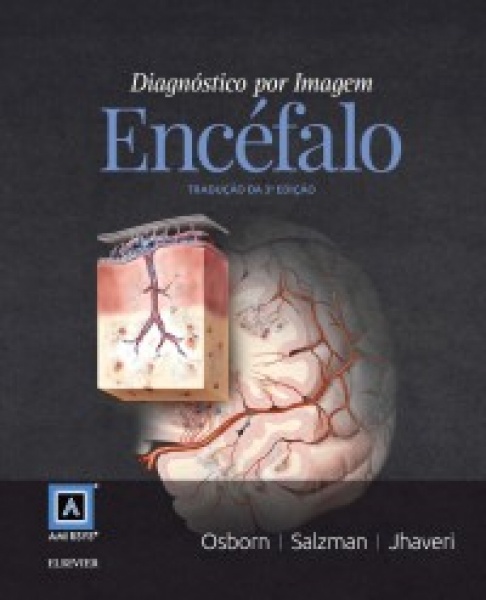 Diagnóstico Por Imagem: Encéfalo- 3A Edição