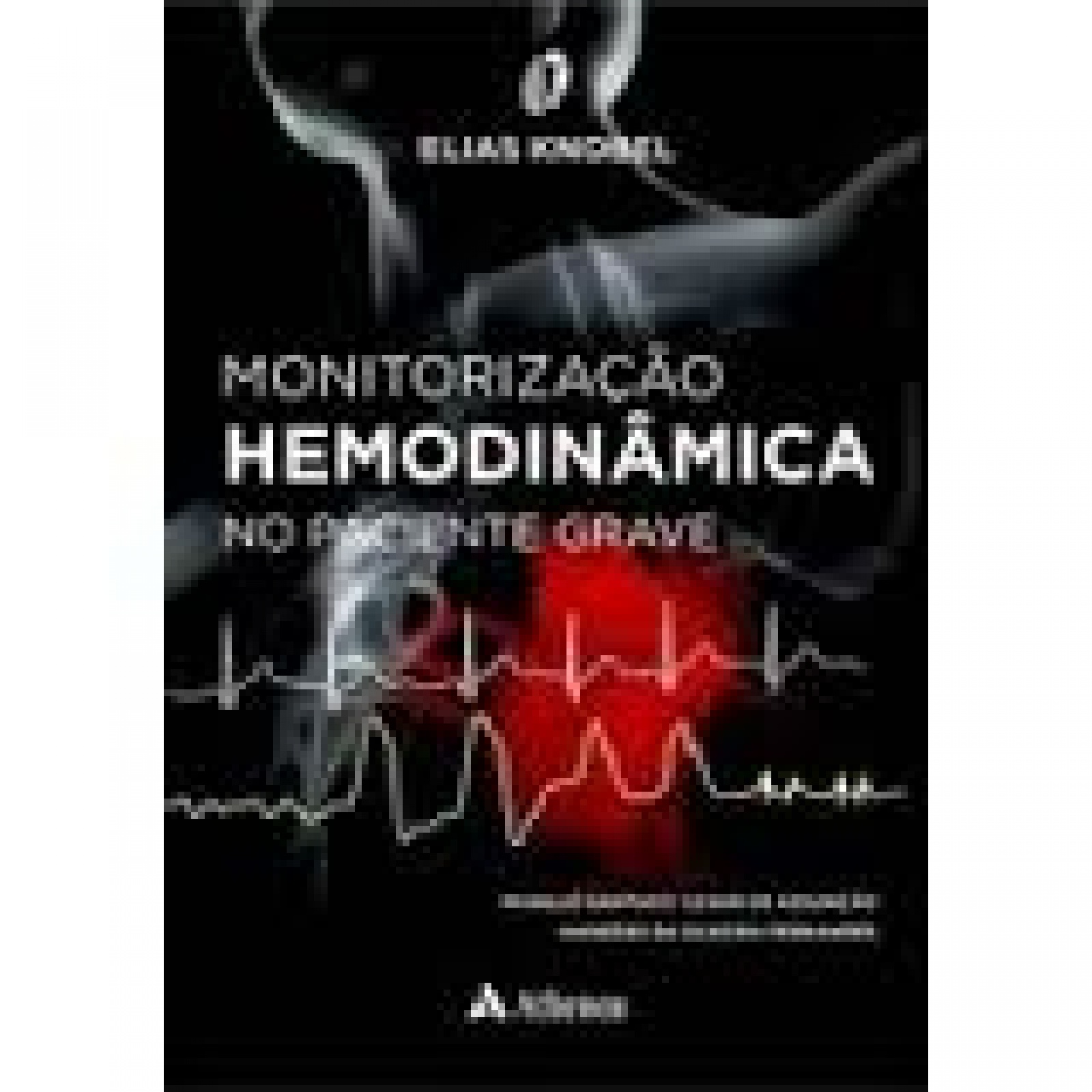 Monitorização Hemodinâmica No Paciente Grave Reimpressão