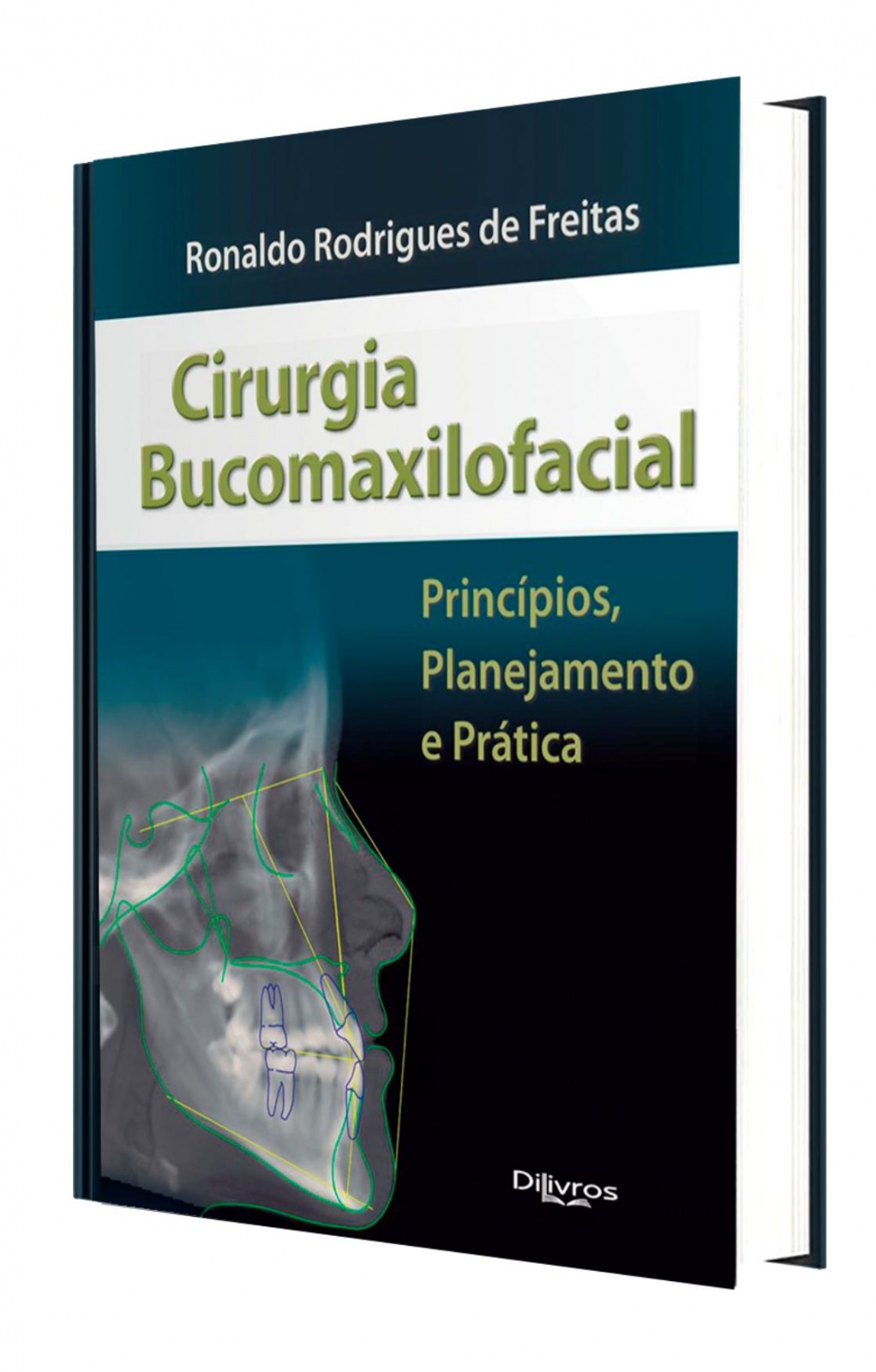 Cirurgia Bucomaxilofacial