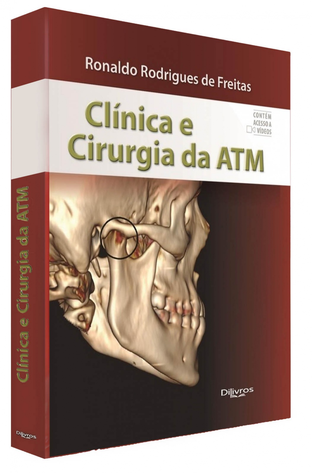 Clinica E Cirurgia Da Atm