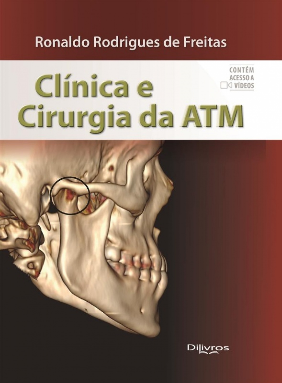 Clinica E Cirurgia Da Atm
