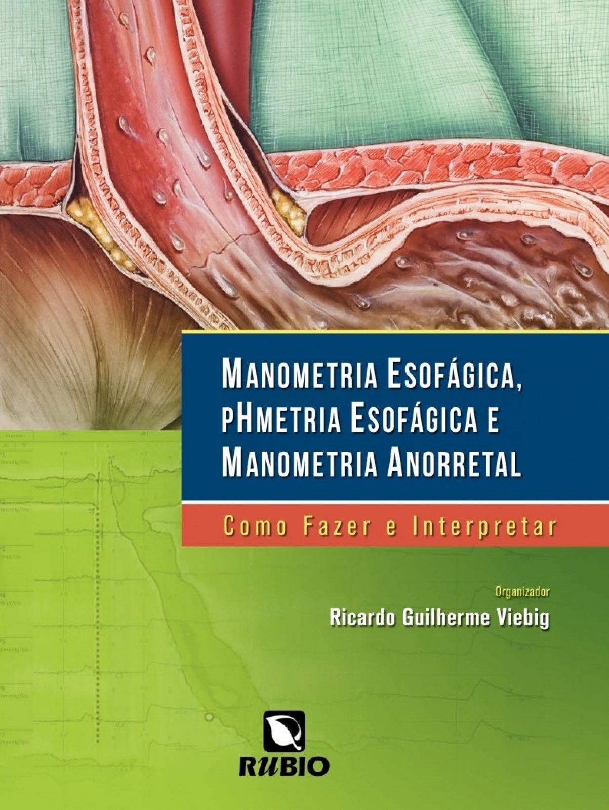 Manometria Esofágica, Phmetria Esofágica e Manometria Anorretal - Como Fazer e Interpretar