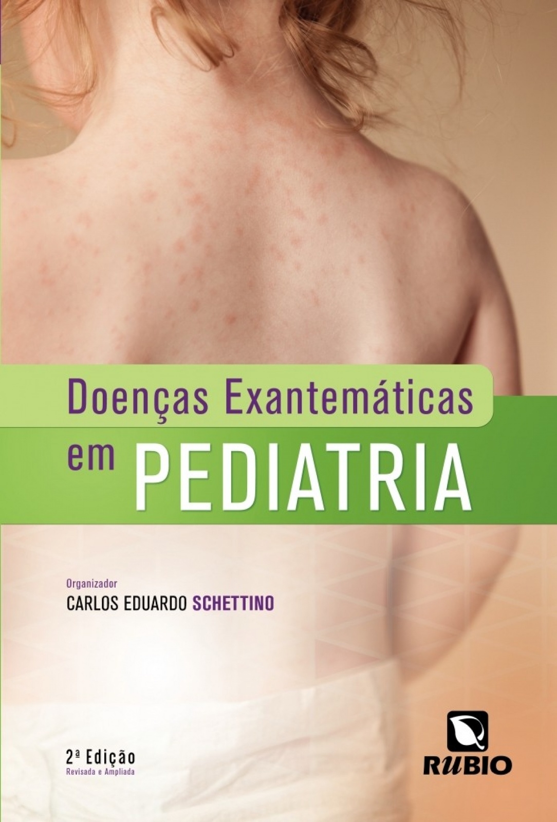 Doenças Exantemáticas em Pediatria