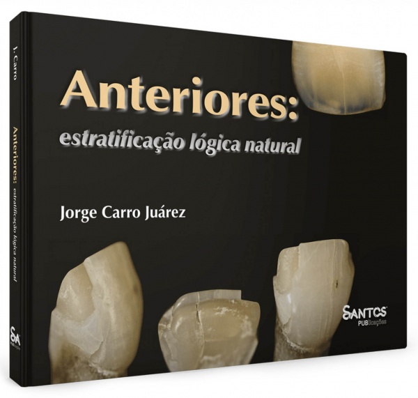 Anteriores: Estratificação Lógica Natural