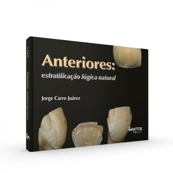 Anteriores: Estratificação Lógica Natural